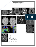 Neuro BN All PDF
