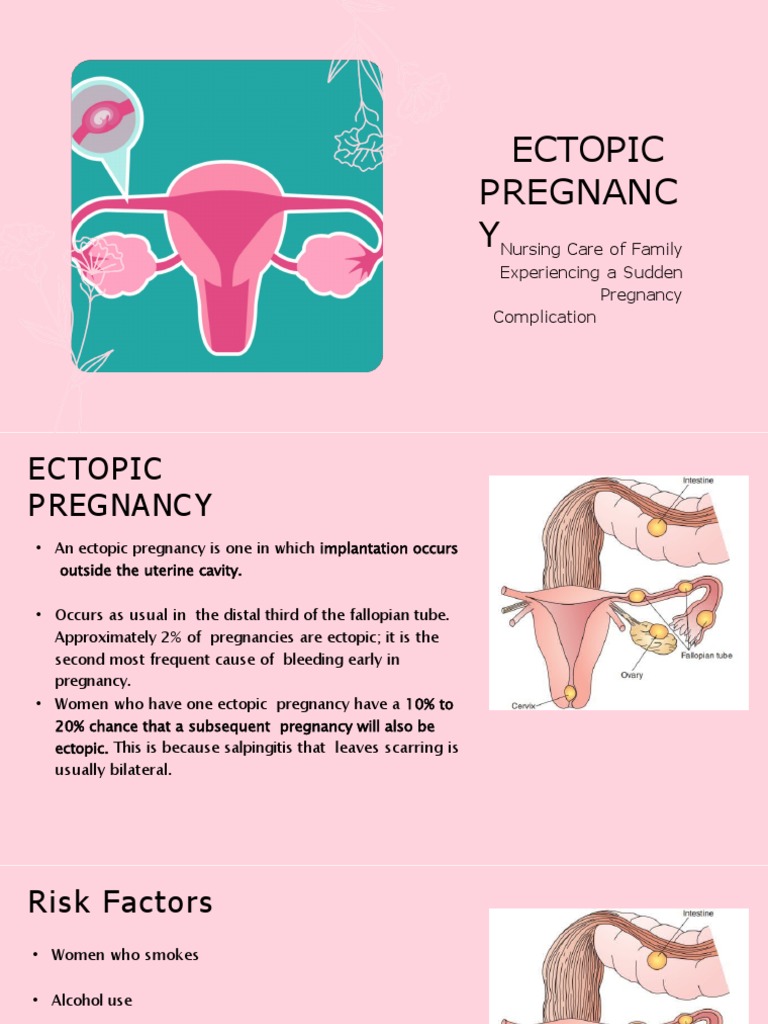 Ectopic Pregnancy | PDF | Pregnancy | Coagulation