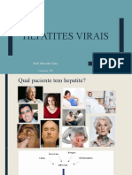 Hepatites Virais UFCG