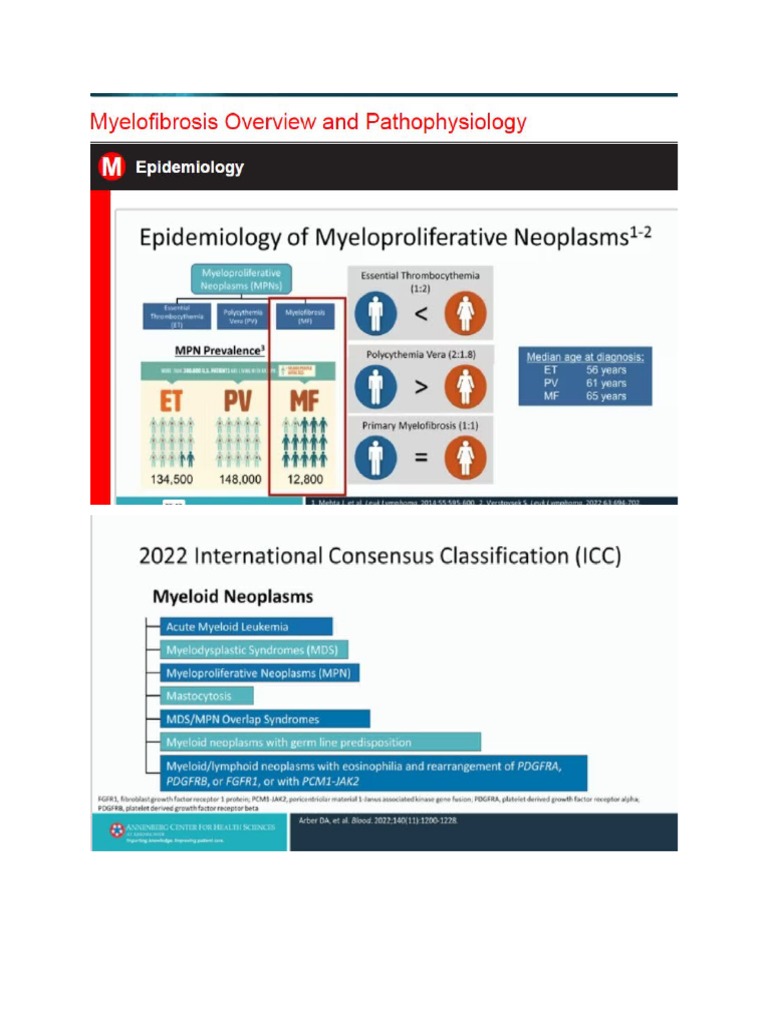 Myelofibrosis 01 | PDF