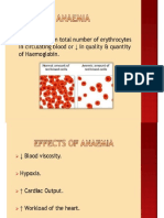 Anemia