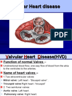 Valvular Heart Disease