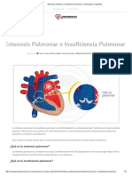 Estenosis Pulmonar e Insuficiencia Pulmonar - Cardiopatias Congenitas