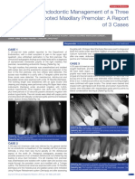 Endodontic Management of A Three Rooted Maxillary Premolar A Report of 3 Cases