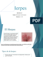 Herpes