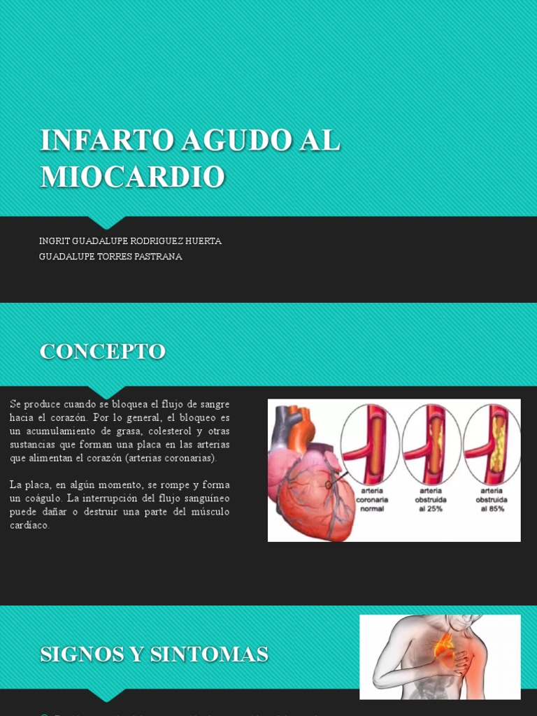 Infarto Agudo al Miocardio: Causas y Síntomas | PDF | Infarto de ...