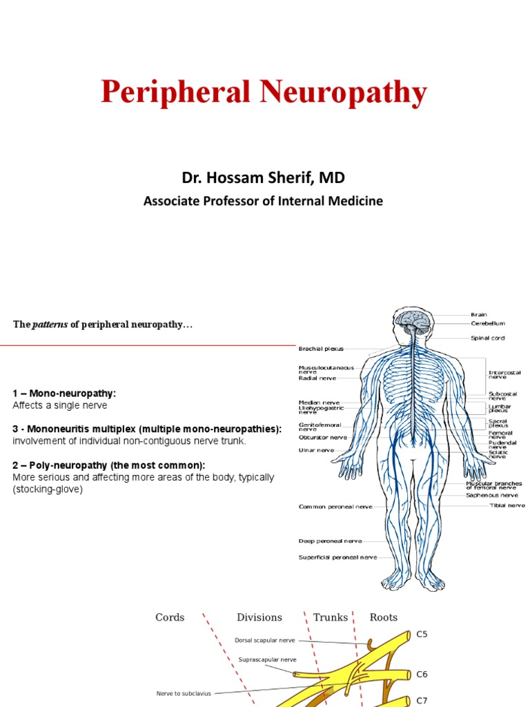 Peripheral Neuropathy | PDF | Peripheral Neuropathy | Paresthesia