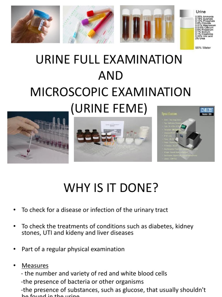 Urine feme test