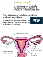 Lect 32 Unit IV Endometriosis 