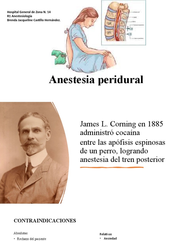 Anestesia Peridural PDF