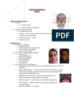 4. Fracturas cigomáticas.docx