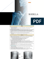 RODILLA