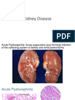 Kidney disease diseases of glomeruli مختبر العملى رقم 1