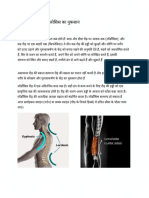 Lordosis Updated