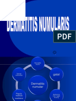 Dermatitis Numular