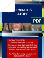 Dermatitis Atopi