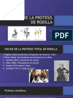 Historia de La Protesis de Rodilla