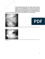 Hirschsprung Disease Imaging