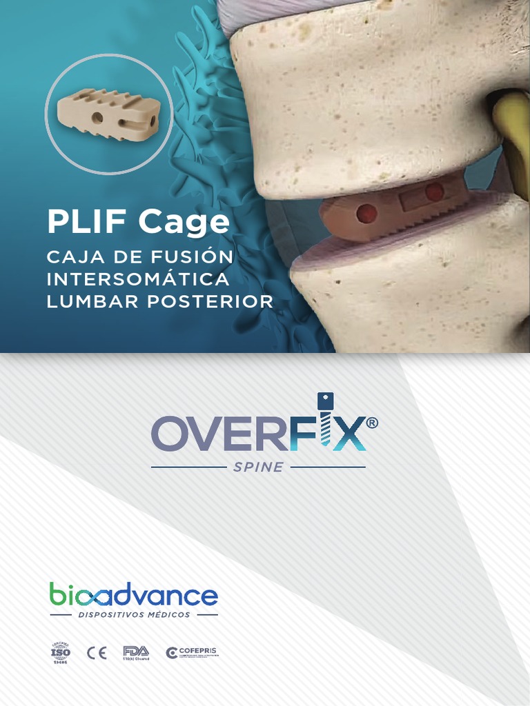 Cajas Intersomáticas Lumbares PLIF | PDF