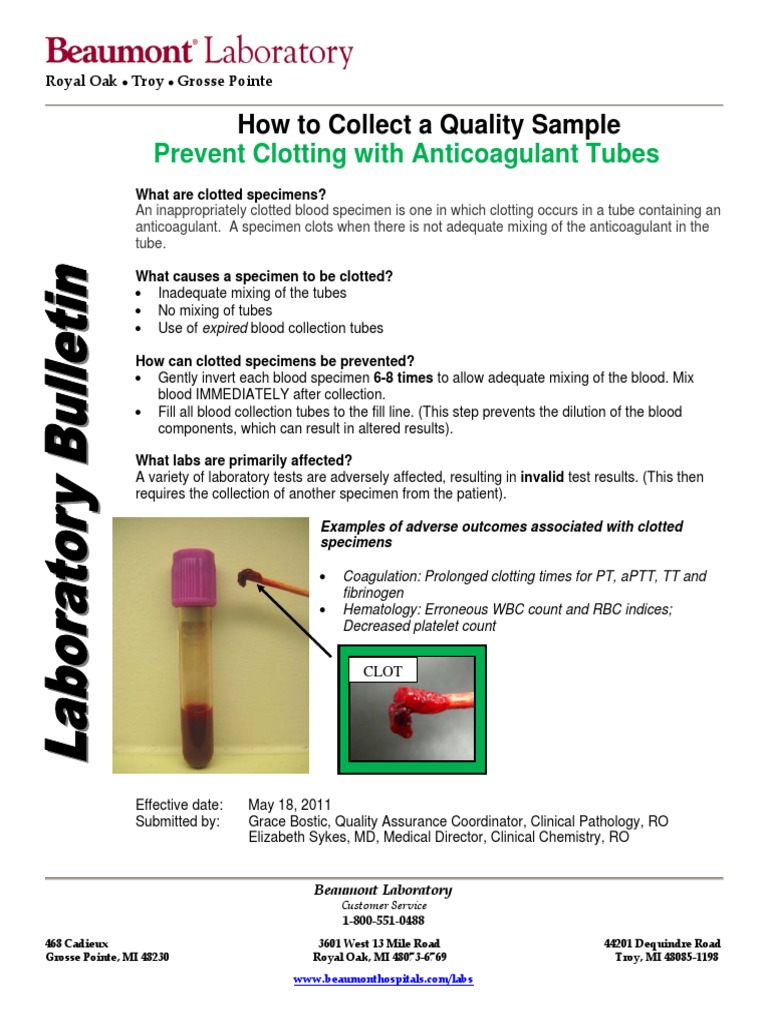 Prevent Clotting With Anticoagulant Tubes PDF Coagulation