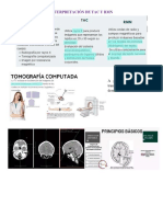 Interpretación de Tac y RMN
