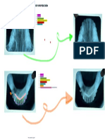 Proyección Oclusal Maxilar Anterior y Proyección Oclusal Mandibular Anterior