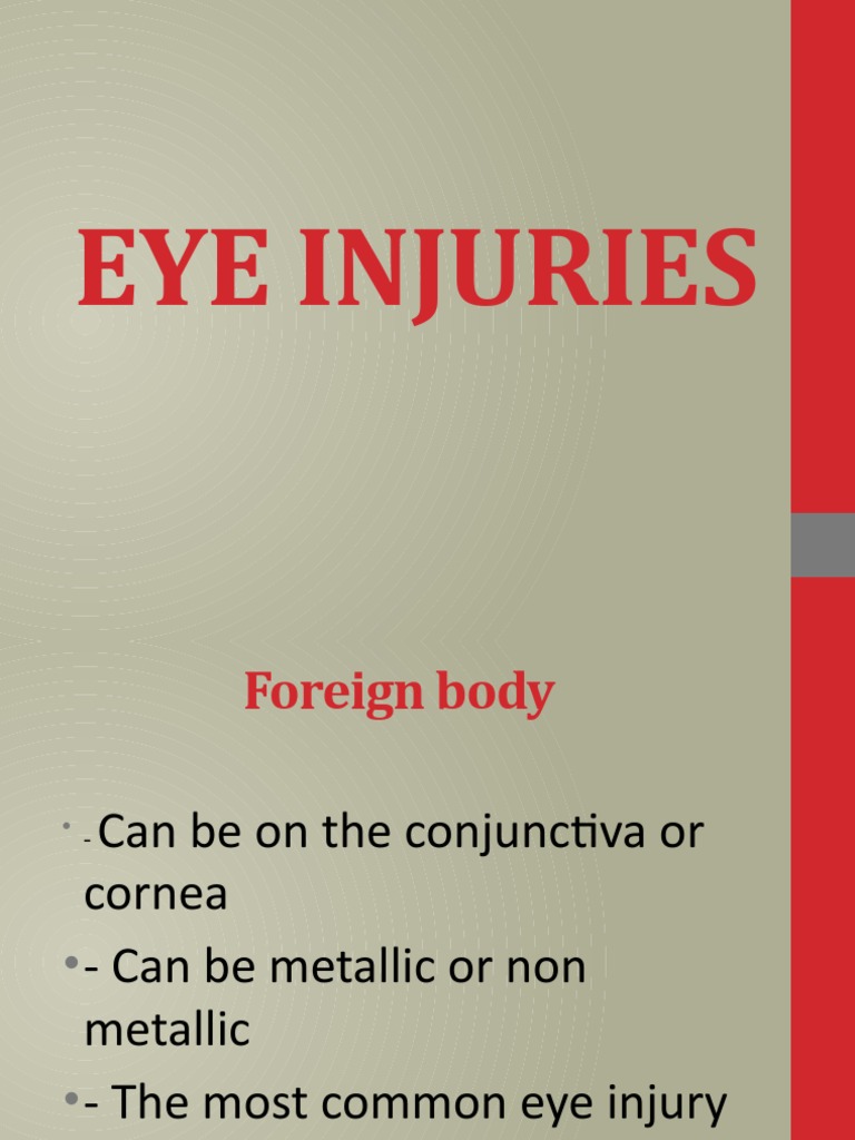 Crenshaw Eye Injury The Hidden Costs Beyond Medical Bills How To Prepare - bz3wmf4