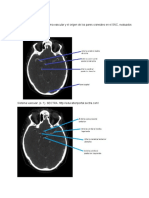 Tarea 1, Contruir, Anatomia Multiplanar