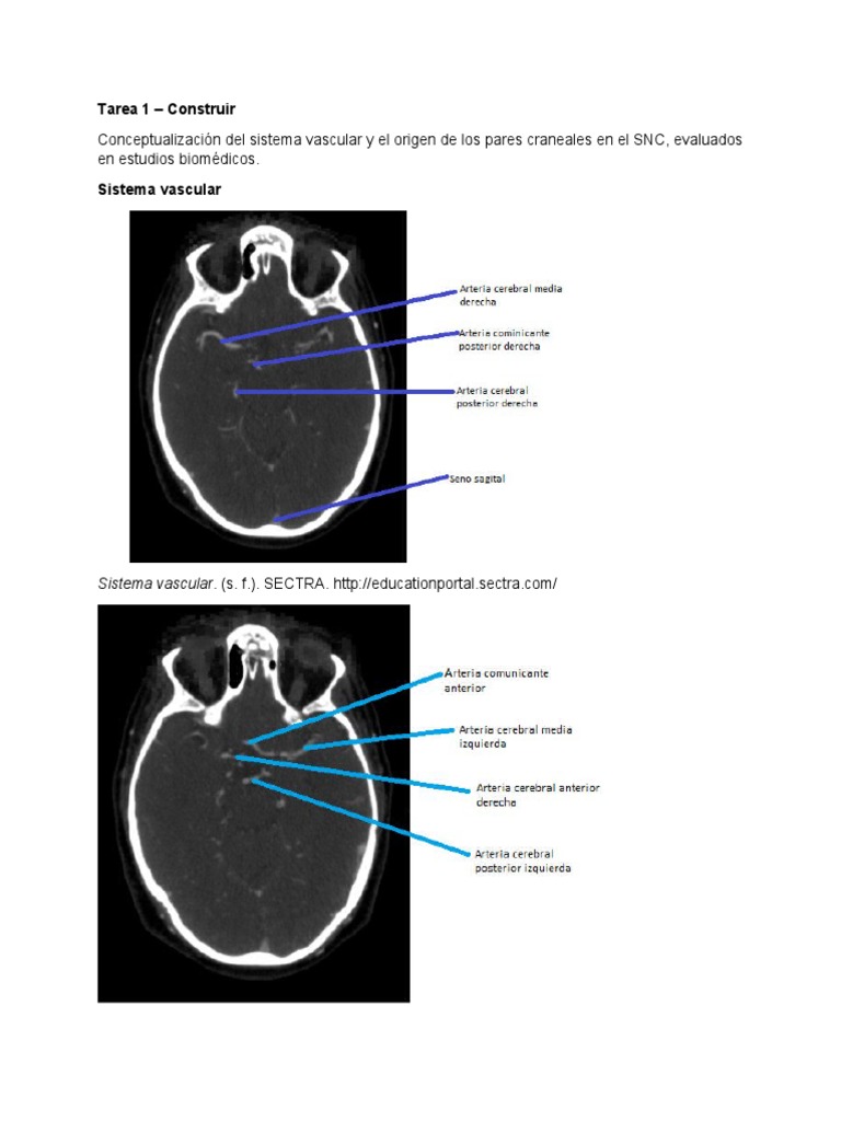 Tarea 1, Contruir, Anatomia Multiplanar | PDF