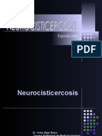 Neurocisticercosis: causa frecuente de epilepsia en zonas endémicas