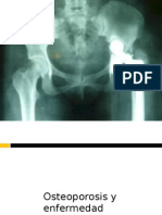 Osteoporosis y Enfermedad Periodontal