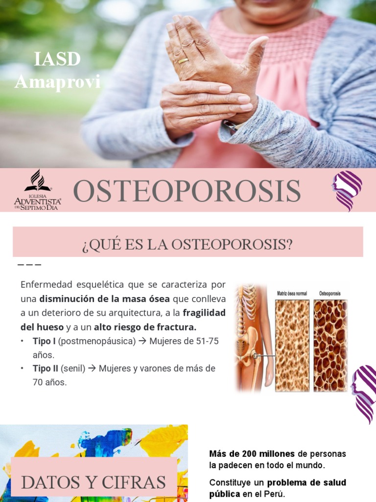 Prevención y Datos sobre Osteoporosis | PDF