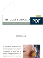 Fistulas y Colostomias