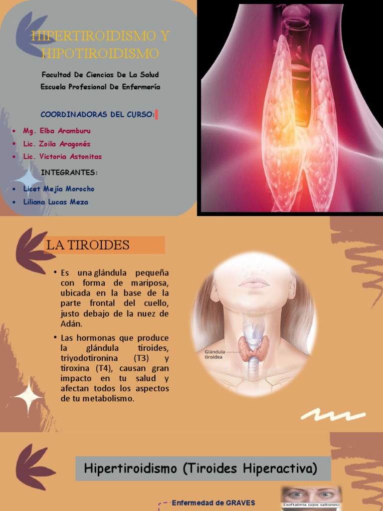 Hipertiroidismo e hipotiroidismo causas, síntomas y cuidados de enfermería PDF Tiroides