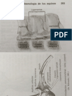 Articulación carpiana izquierda y ligamentos