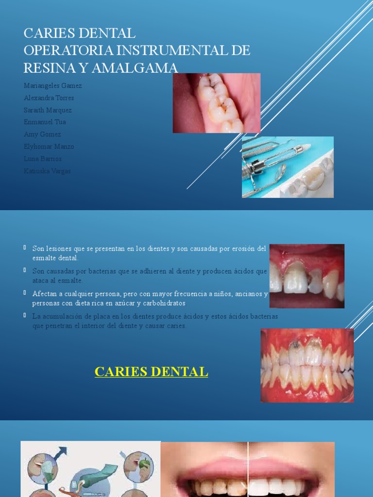 Caries dental pdf ciencias de la salud especialidades medicas