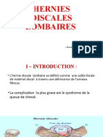 2-Hernies Discales Lombaires, Par Dr. Abdelli
