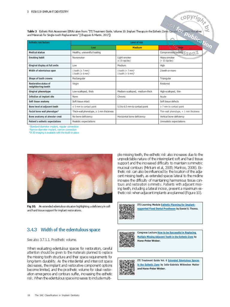 Esthetic Risk Factors in Implant Dentistry | PDF | Dental Implant ...