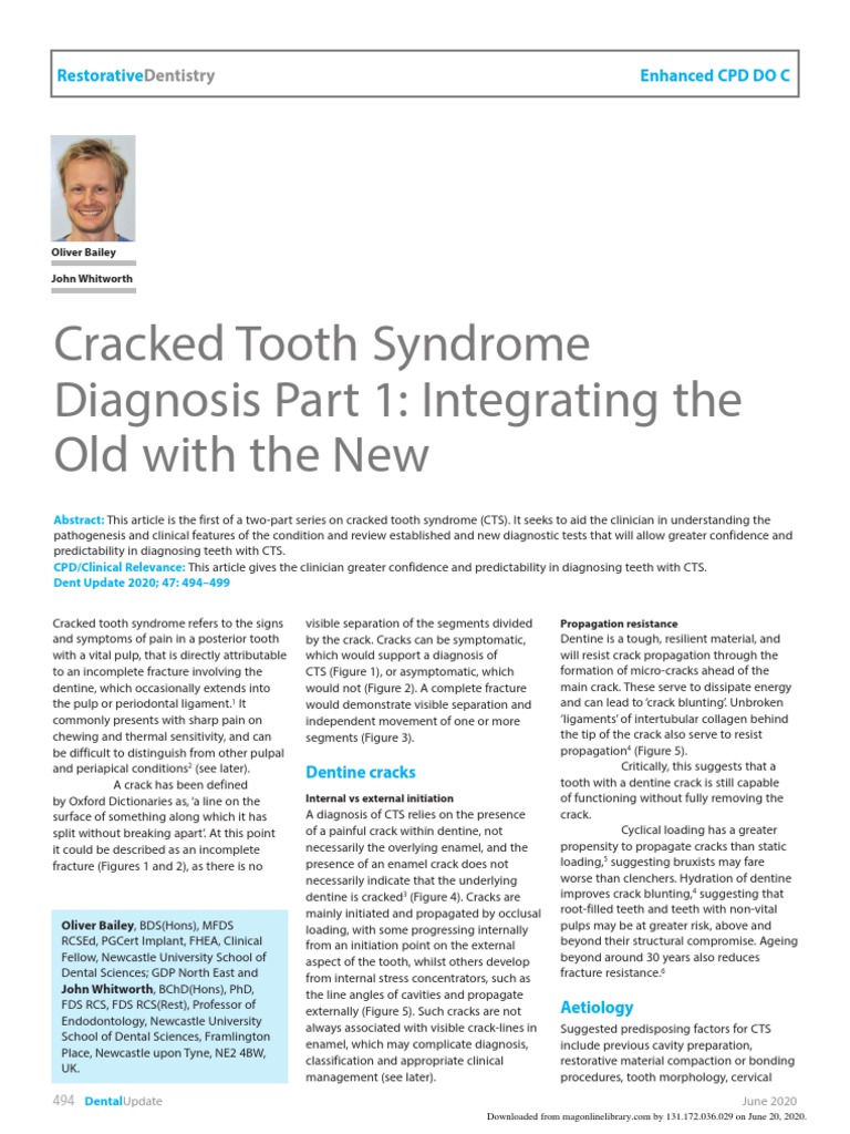 Cracked Tooth Syndrome Part 1 Integrating Established and New Diagnostic Tests to Improve