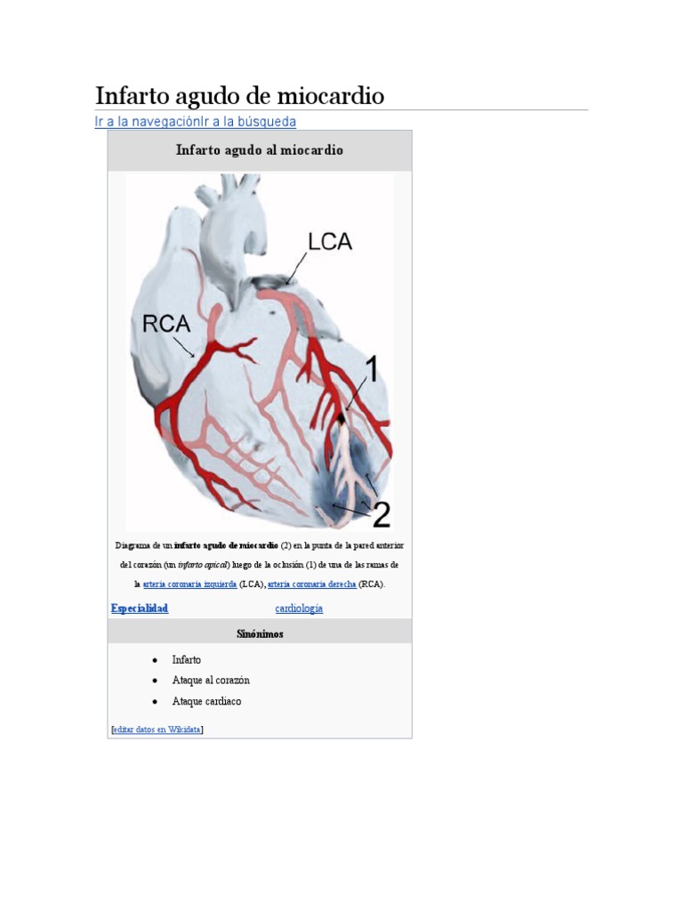 Infarto agudo de miocardio | PDF | Infarto de miocardio | Causas de la ...