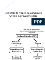 Curs 2 ECG Tulburari de Ritm Si de Conducere