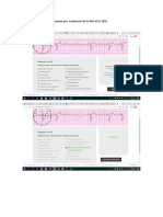 Pre Evaluacion SVCA ACLS AHA 2015 Con Los Trazados Del EKG y Respuestas