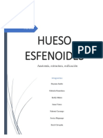 Informe Hueso Esfenoides