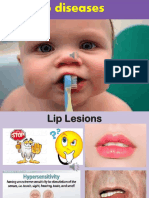 Lip Diseases