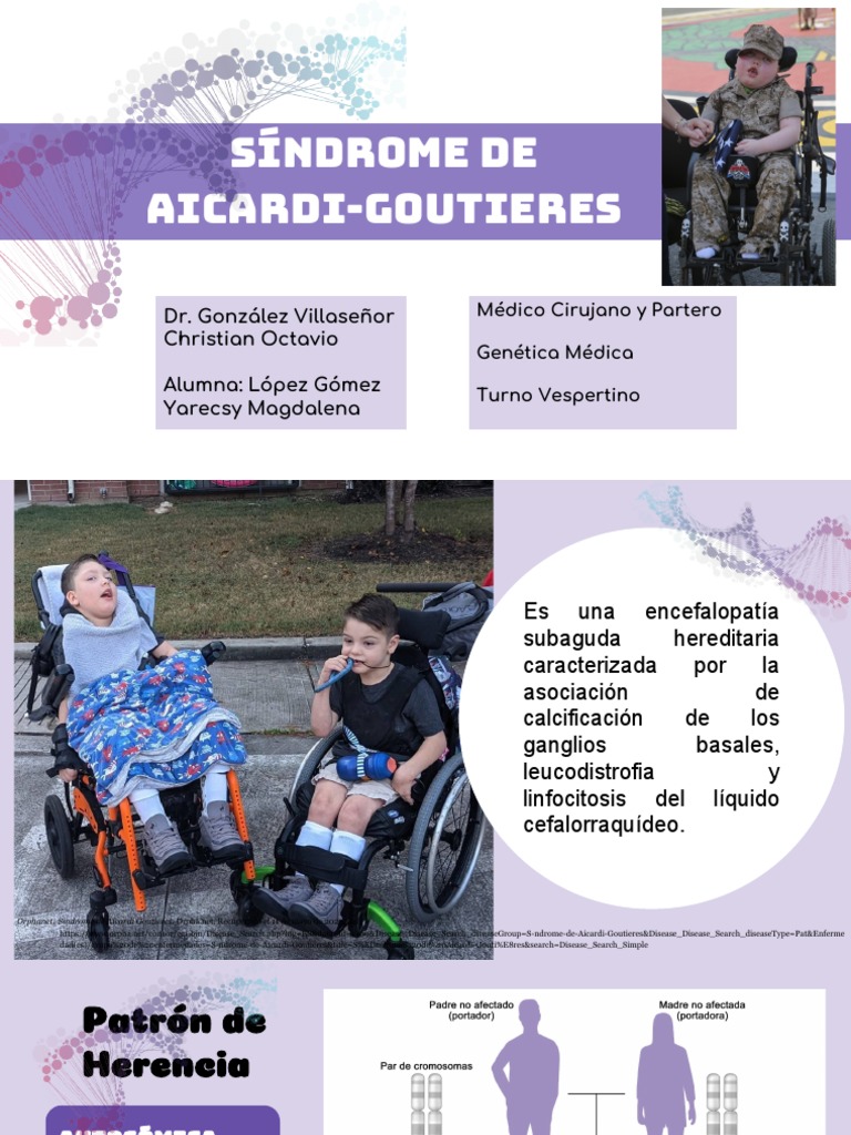 Génetica - Sindrome de Aicardi | PDF | Gene | Causas de la muerte