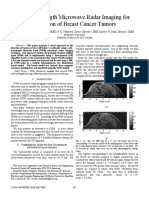 6-Sub-Wavelength Microwave Radar Imaging For Detection of Breast Cancer Tumors