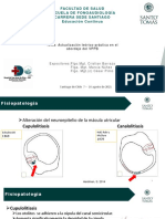 Fisiopatología VPPB