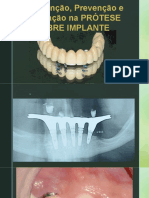 Manutenção e Prevenção de Implantes PARA ABO 2023