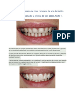 Full-Mouth Adhesive Rehabilitation Part. 1.en - Es