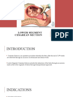 Lower Segment Cesarean Section